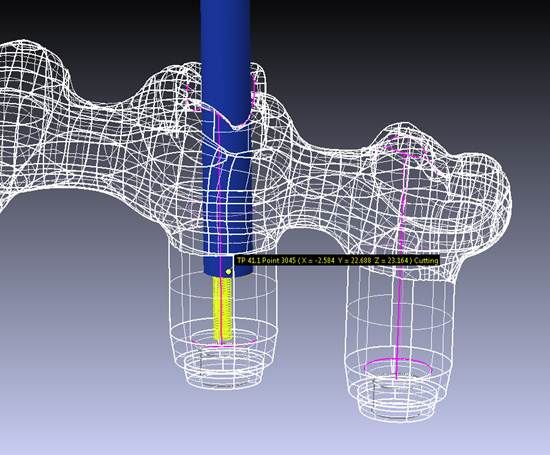 CAD/CAM Frässtrategien